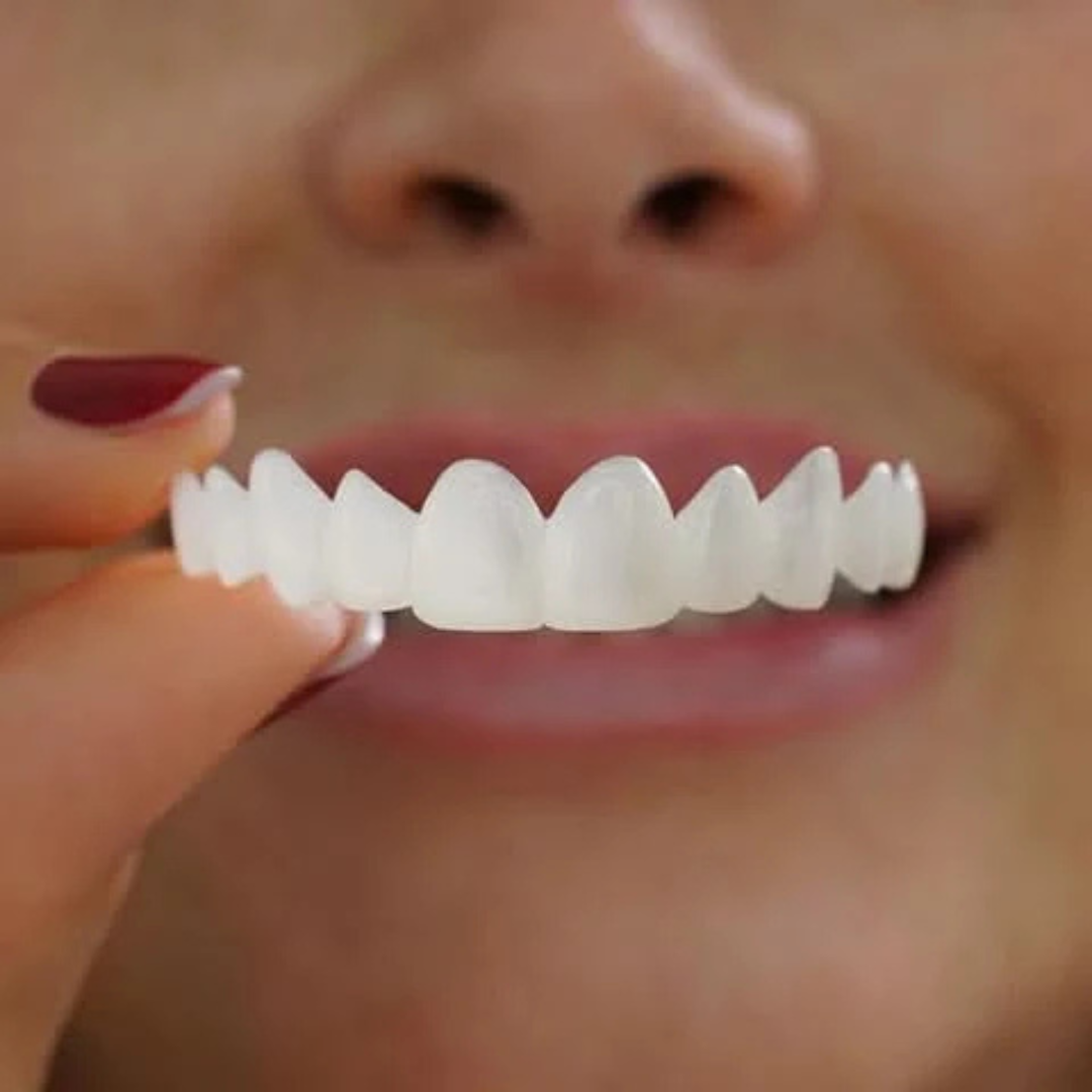 VelarpSmileFlex™